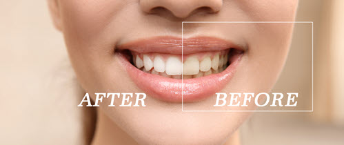 Cosmetic Dentistry