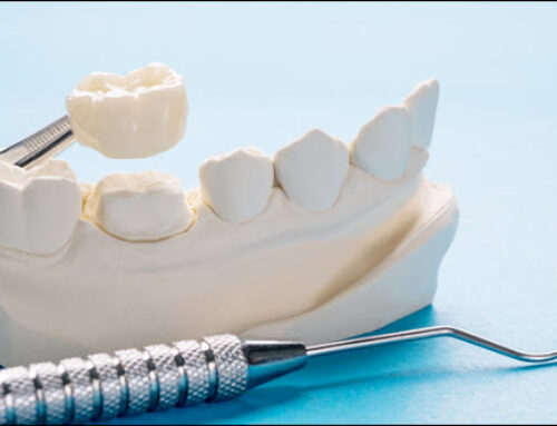 Dental Crowns: Protect and Perfect Your Smile