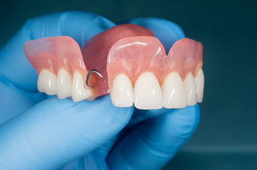 Dentures (Full and Partial)