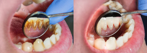 Periodontal Dentistry