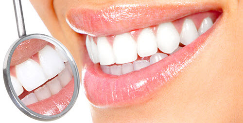 Teeth Whitening