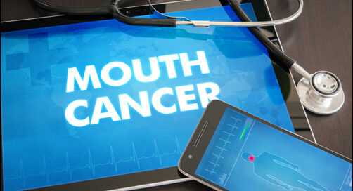 Oral Cancer