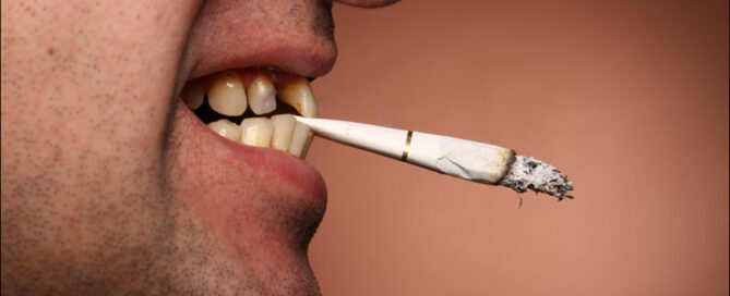 Smoking