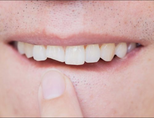 Restoring Damaged Teeth: Modern Solutions for a Healthy Smile